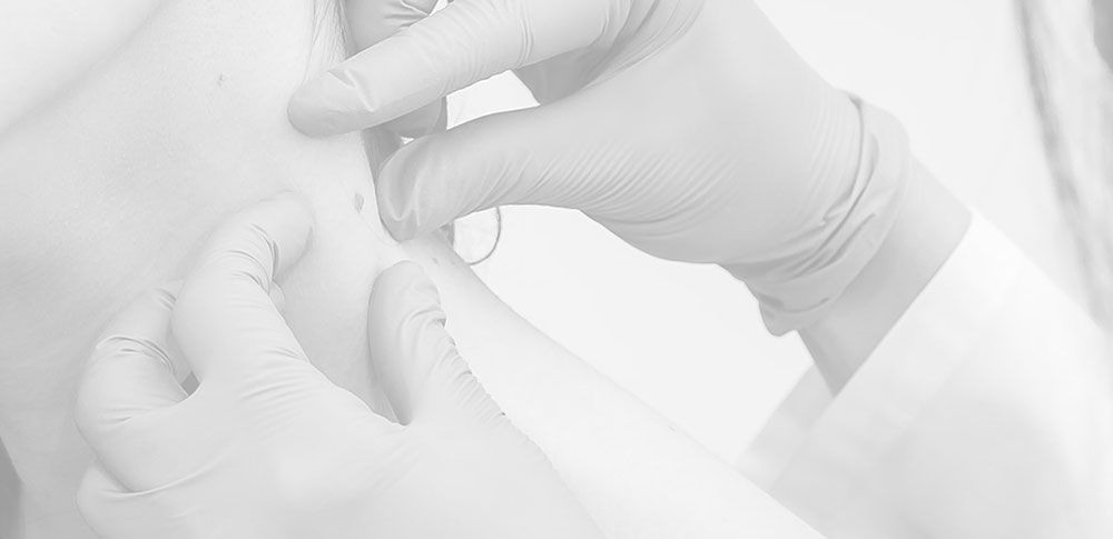 Chirurgie plastica reconstructiva - Omini Clinic - Iasi