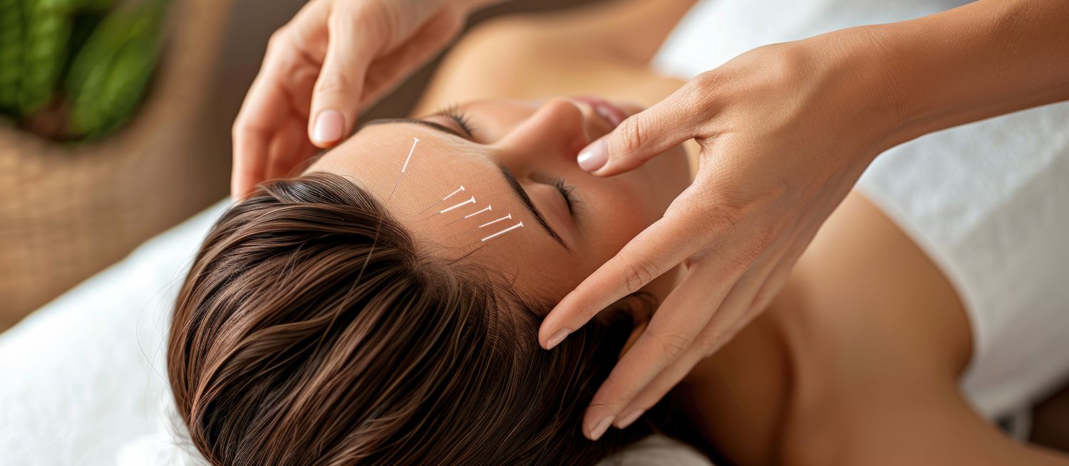 NOU - Acupunctura pentru reîntinerirea faciala. CLINICA TRAUN-MED - Timisoara